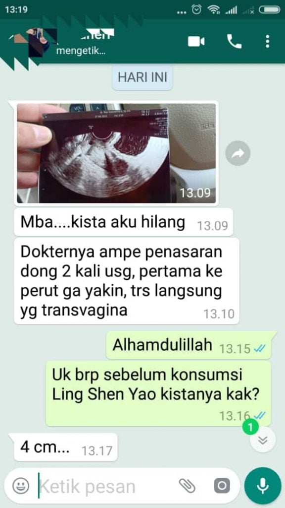 kista hilang dokter penasaran